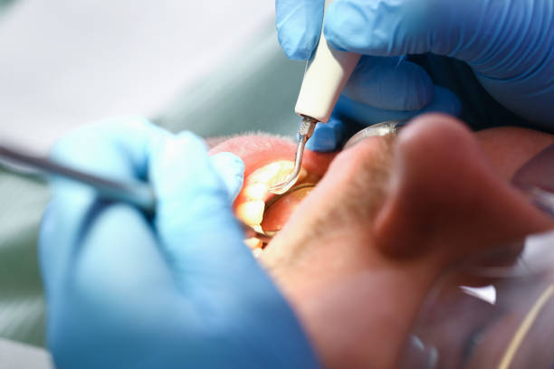Best Knocked-Out Tooth Emergency  in Stuart, FL